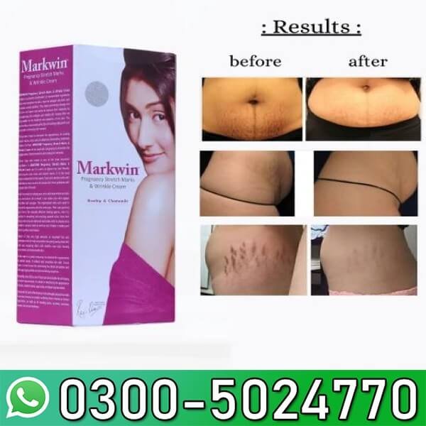  Markwin Cream Price in Pakistan