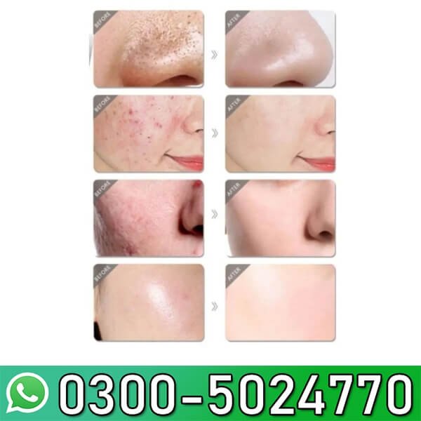 Melona R Serum 30ml In Pakistan